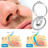ERROR Anti-Snoring Corrector Snore Prevention Gadget Women's Anti-Snore Device Snore Elimination Nose Clip Men's Sleep Night