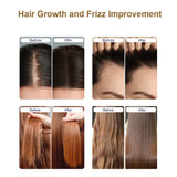 Scalp Oil Liquid Applicator Electric Head Comb Massager 625nm LED Light Therapy Vibration Medicine Hair Growth Massage Combs