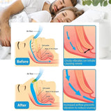 ERROR Anti-Snoring Corrector Snore Prevention Gadget Women's Anti-Snore Device Snore Elimination Nose Clip Men's Sleep Night