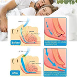 ERROR Anti-Snoring Corrector Snore Prevention Gadget Women's Anti-Snore Device Snore Elimination Nose Clip Men's Sleep Night